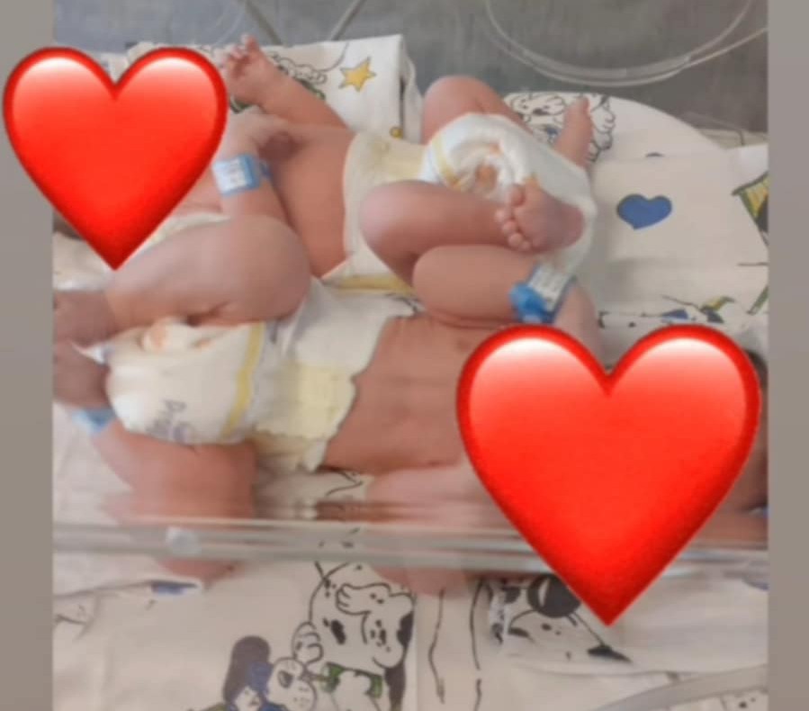 PIEDIMONTE MATESE, FRANCESCO E FEDERICO, DUE SPLENDIDI GEMELLINI PER DARE VITA AL PUNTO NASCITA DELL’OSPEDALE
